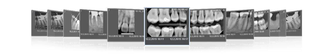 Planmeca ProX intraoral x-ray images