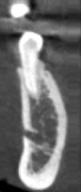 Imaging low dose mode voxel size 400