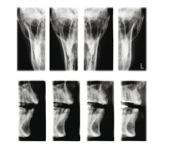 Planmeca ProMax 2D x-ray